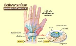 ฮั้วลักเซียมกับมือชาเท้าชา