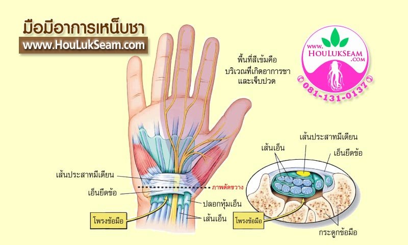 มือชาเท้าชา