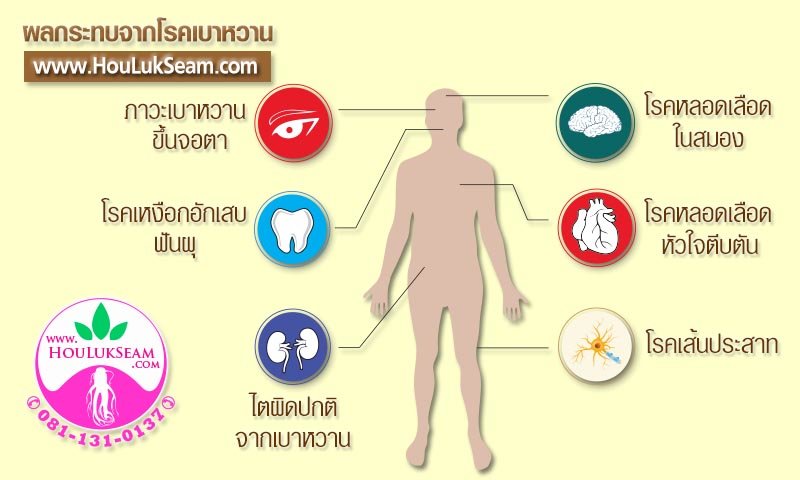 ฮั้วลักเซียมกับโรคเบาหวาน