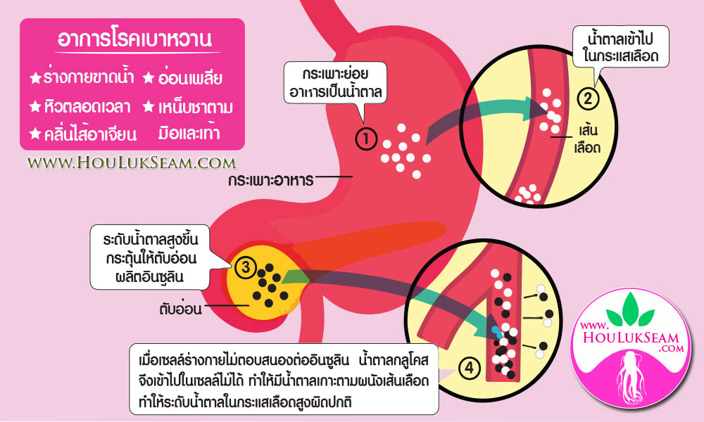 การรักษาโรคเบาหวานด้วยแพทย์แผนจีน