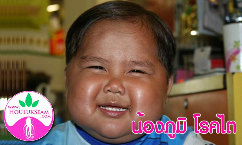 น้องภูมิ โรคไต